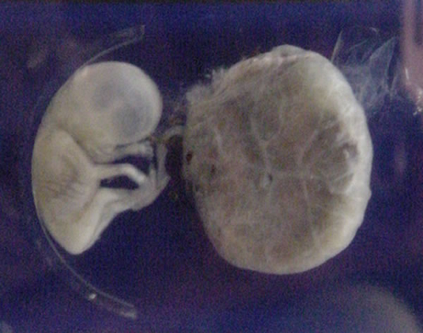 Pictures Of Two Month Old Baby In The Womb 59