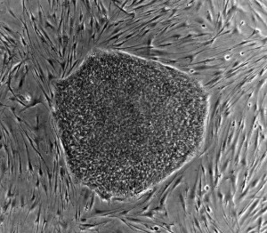 Human embryonic stem cell colony phase